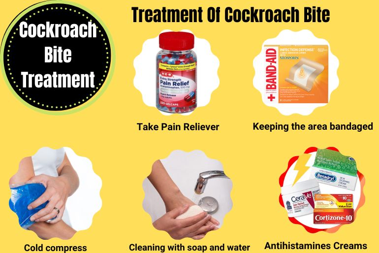 Treatment For Cockroach Bite
