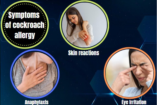 Symptoms of cockroach allergy