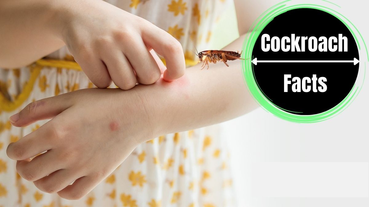 Cockroach Bite Marks